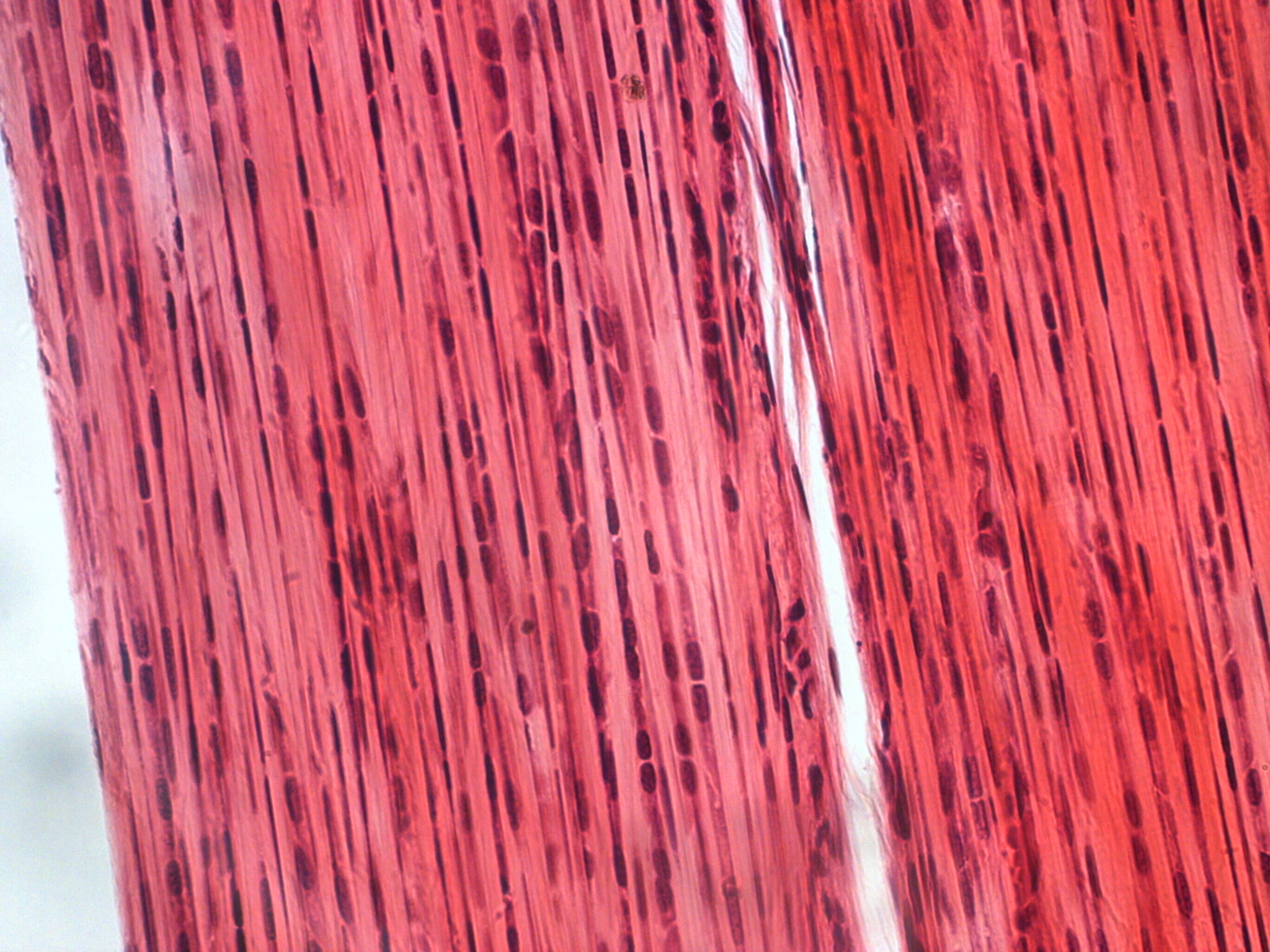 Connective and epithelial tissue